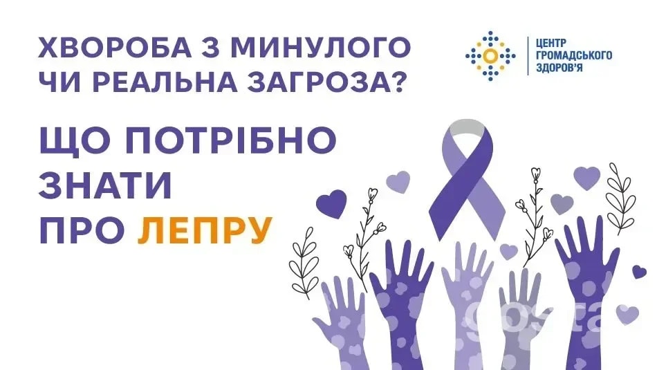 Лепра у 2026: 200 тисяч випадків на рік, троє пацієнтів в Україні – міфи та факти про хворобу Гансена