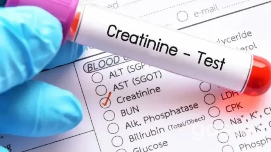 Який аналіз дозволяє визначити рівень креатиніну?
