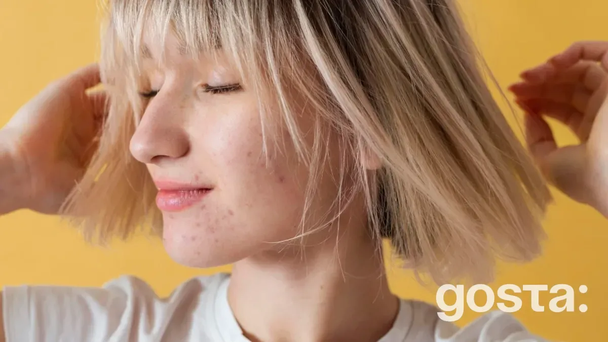 Огляд дієвих засобів для догляду за проблемною шкірою