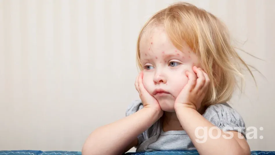 How chickenpox spreads