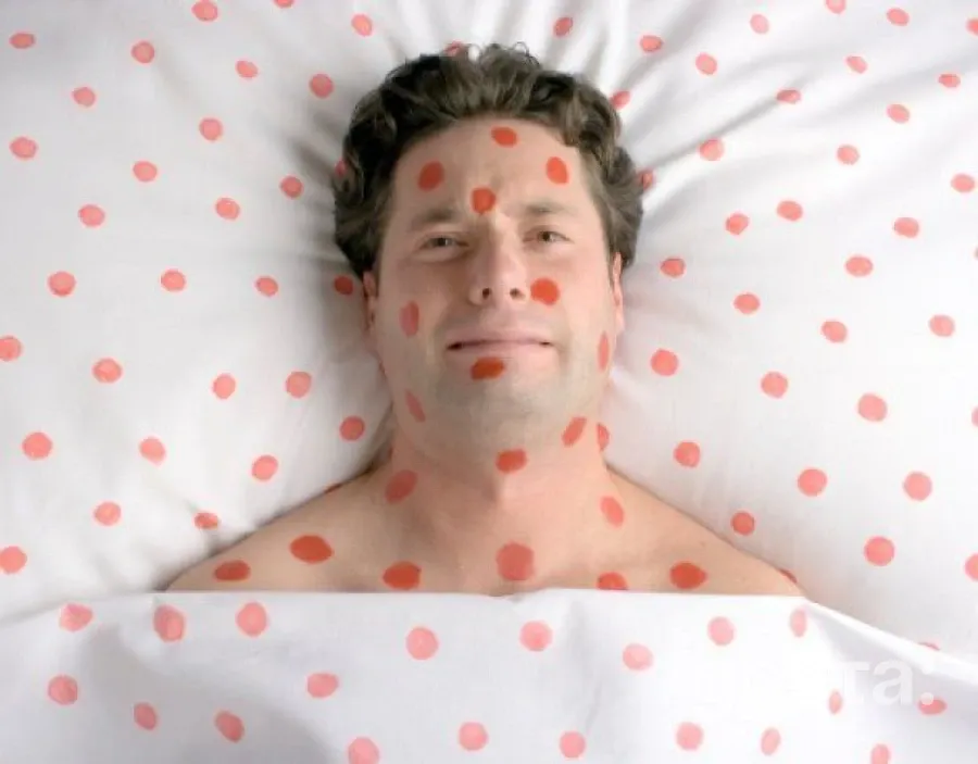 Зростає загроза кору в прикордонних регіонах України