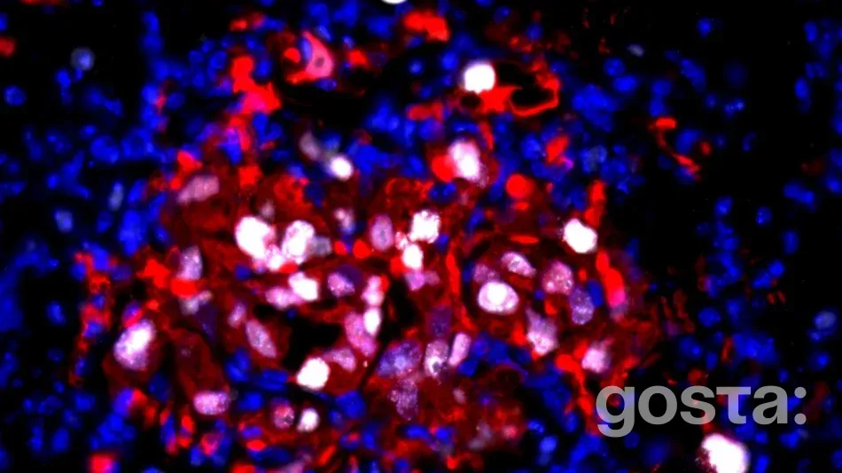 Дослідження показали, що запалення може пробуджувати сплячі ракові клітини