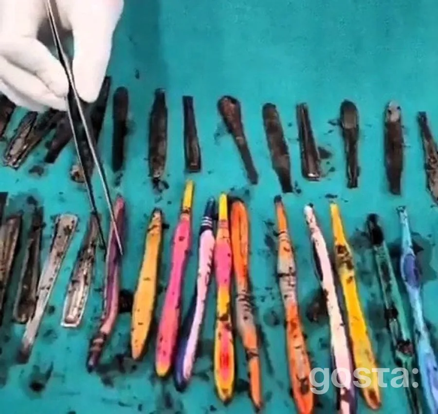 Негайна операція врятувала життя пацієнта