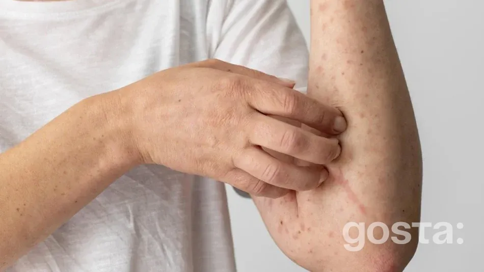 висип при скарлатині на руках