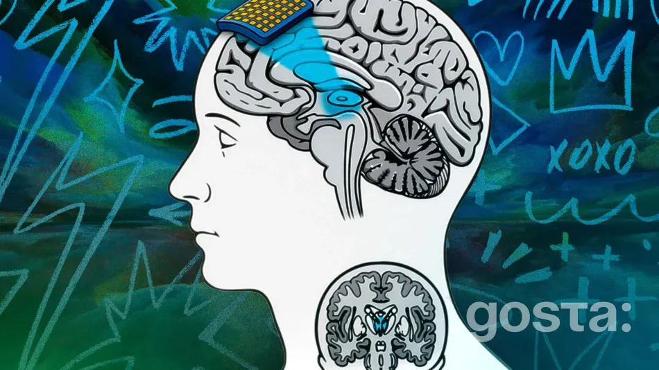 Транскраніальний фокусований ультразвук: MIT готує експерименти для перевірки теорій про свідомість