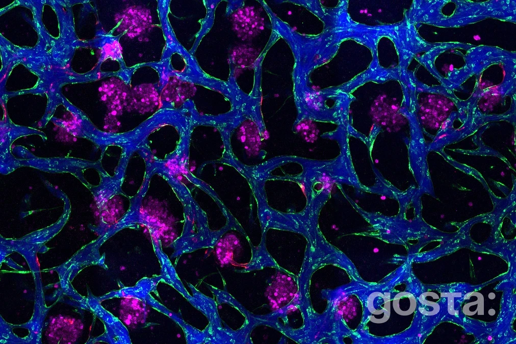 MIT показав, як зупинити MASLD: чи змінить нова модель печінки підхід до лікування для понад 100 мільйонів пацієнтів?