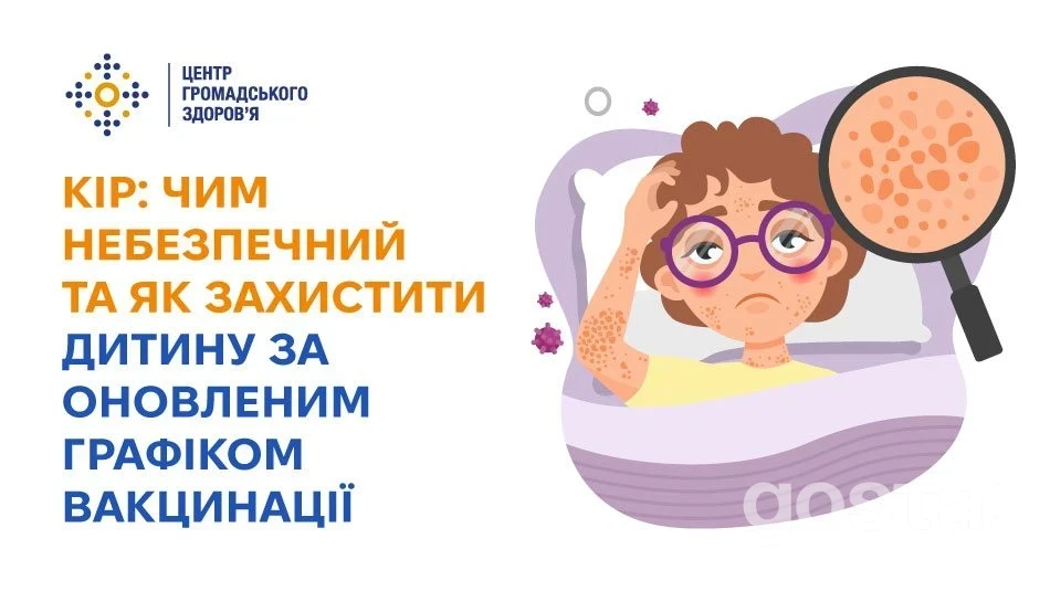 Кір: 9 із 10 невакцинованих заражаються після контакту — що змінюється у графіку щеплень з 2026 року