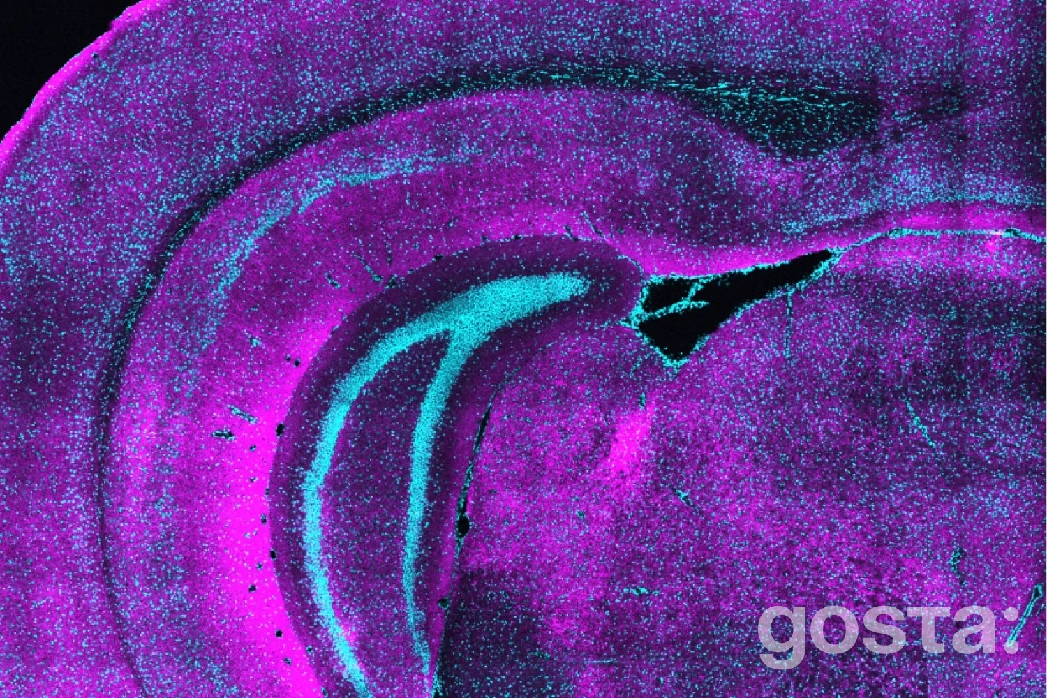 Розвиток мозку: нейрони SST запускають критичний період без зорового досвіду – нові дані MIT