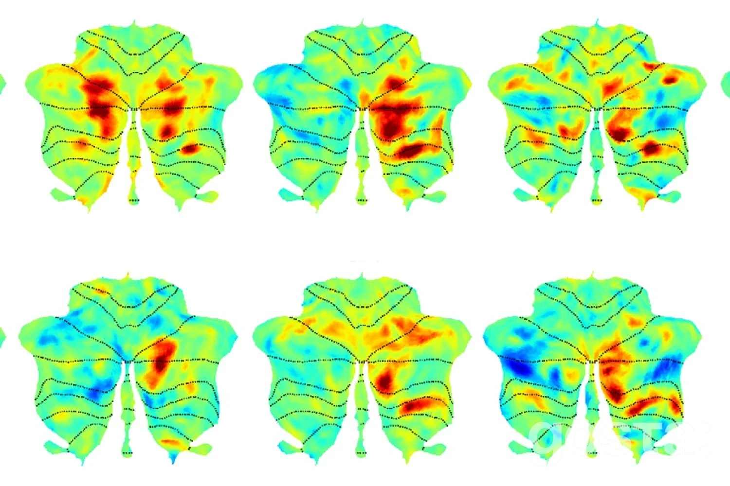 Мовна мережа мозку виходить за межі неокортексу: вчені MIT виявили «супутник» у мозочку